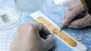 Injerto capilar en Barcelona: guía completa para hombres y mujeres 9 pexels drmkhawarnazir 27138343