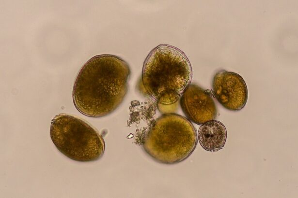 Gambierdiscus australes en microscopio óptico invertido.